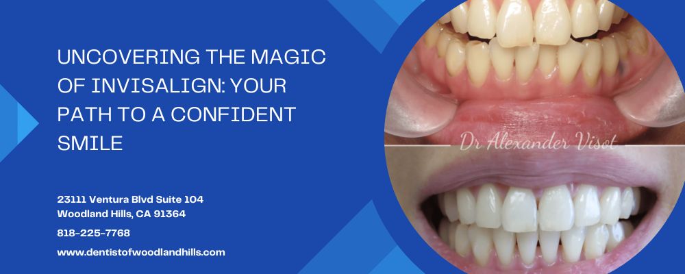 Uncovering the Magic of Invisalign: Your Path to a Confident Smile