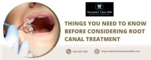 Things You Need to Know Before Considering Root Canal Treatment