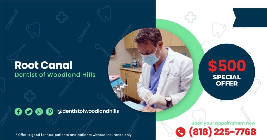 ROOT CANAL OFFER